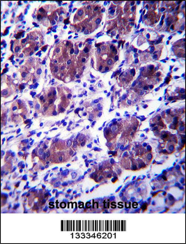 CCDC22 Antibody (C-term)