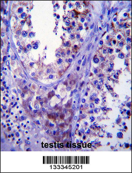 SDF2L1 Antibody (C-term)