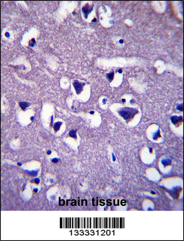 CCDC117 Antibody (C-term)