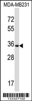 DTX3 Antibody (N-term )