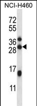 C17orf95 Antibody (C-term)
