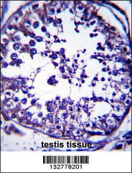 RAB5C Antibody (C-term)