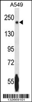 NRK Antibody (Center)