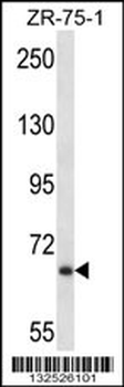 JPH2 Antibody (C-term)