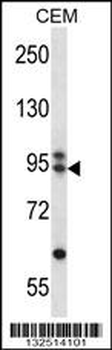 ARMC9 Antibody (N-term)