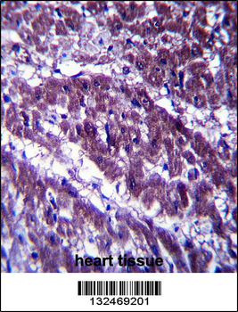 OGDH Antibody (C-term)