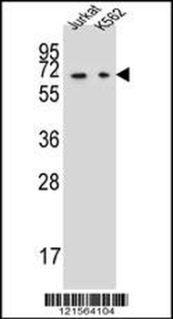 DPYS Antibody (C-term)