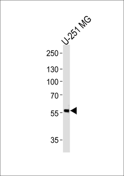 PHF17 Antibody (N-term)