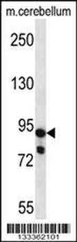 USP45 Antibody (Center)