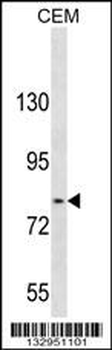 TGFBRAP1 Antibody (C-term)