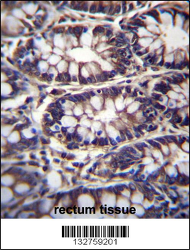 TTC15 Antibody (C-term)