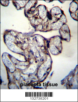 BNIP2 Antibody (C-term)