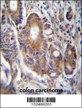 RAB21 Antibody (C-term)