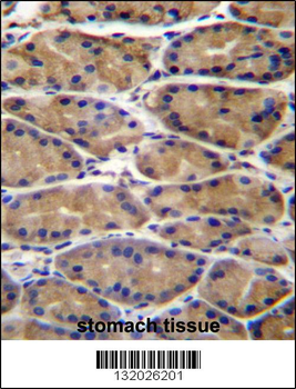 UPRT Antibody (C-term)