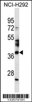 SPATA4 Antibody (Center)