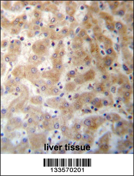 DHFRL1 Antibody (Center)