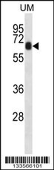 CCDC120 Antibody (N-term)