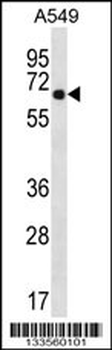 WSCD2 Antibody (C-term)