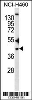 ZDHHC20 Antibody (N-term)