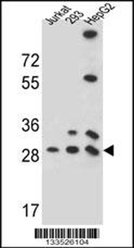 PGAM4 Antibody (N-term)