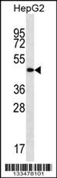 TMCC3 Antibody (Center)