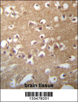 TMCC3 Antibody (Center)