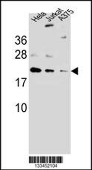 ARL6IP6 Antibody (N-term)