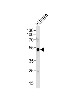 ELAVL3 Antibody (N-term)