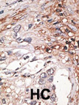 HtrA3 Antibody (C-term)