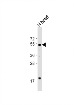 HtrA3 Antibody (N-term)