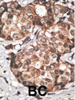 HtrA3 Antibody (N-term)