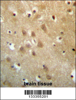 ZNF227 Antibody (N-term )