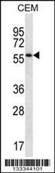 MOSPD2 Antibody (N-term )