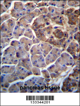 MOSPD2 Antibody (N-term )