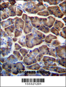 KCTD3 Antibody (C-term)