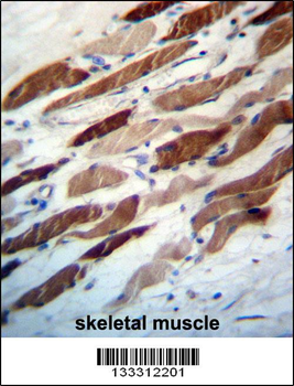 WIPI2 Antibody (N-term)