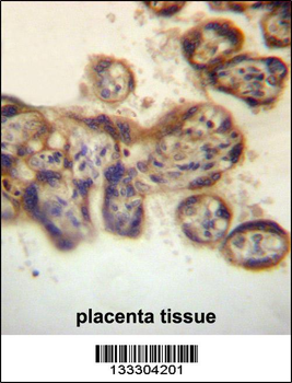 PTPN2 Antibody (C-term)