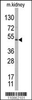 TASP1 Antibody (C-term)