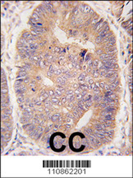TASP1 Antibody (C-term)