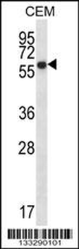 ERO1L Antibody (C-term)