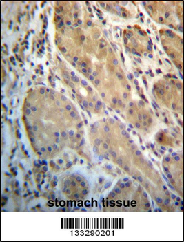 ERO1L Antibody (C-term)