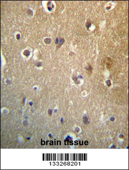 HDAC3 Antibody (C-term)