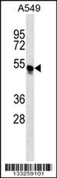 TRIM54 Antibody (N-term)