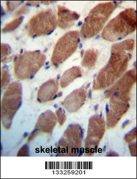 TRIM54 Antibody (N-term)