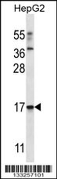 TRIM48 Antibody (N-term)