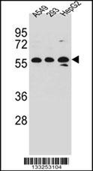 TRIM4 Antibody (N-term)