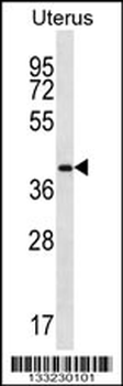 OR2V2 Antibody (C-term)