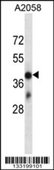 OR4D6 Antibody (C-term)