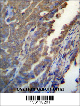 ASB4 Antibody (C-term)