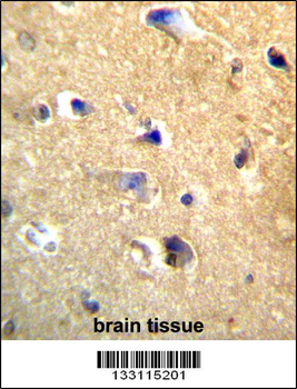 CDH22 Antibody (Center)